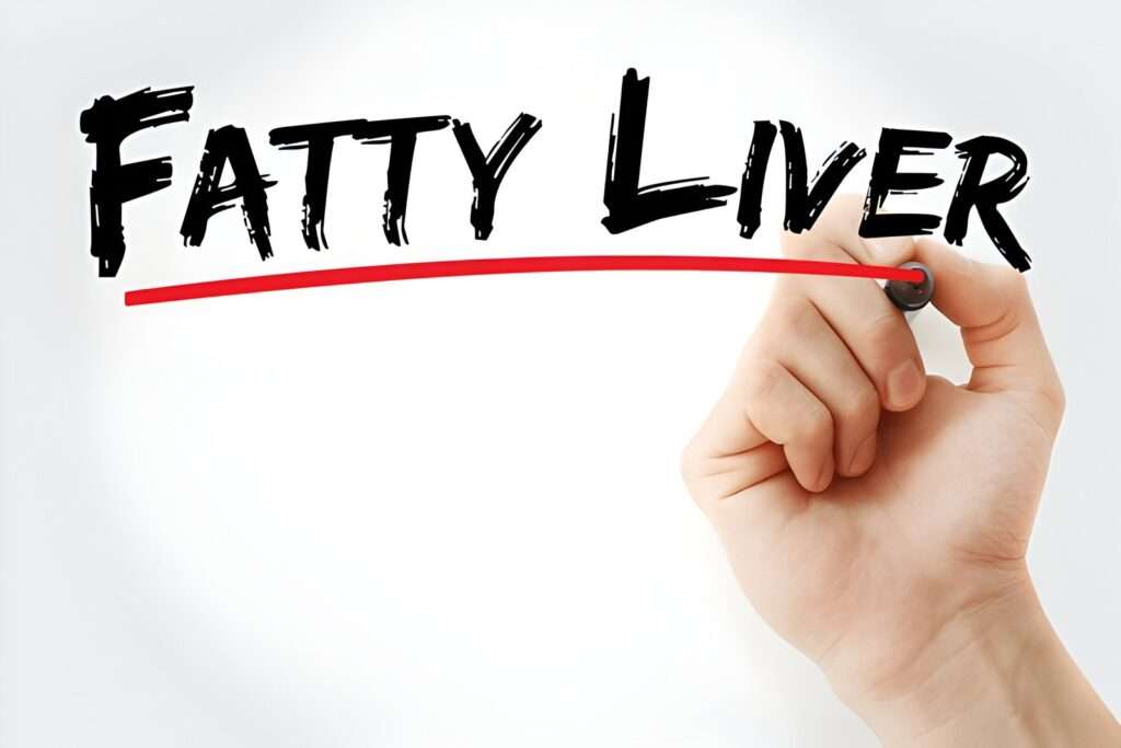 How Fatty Liver Disease Impacts Life Expectancy